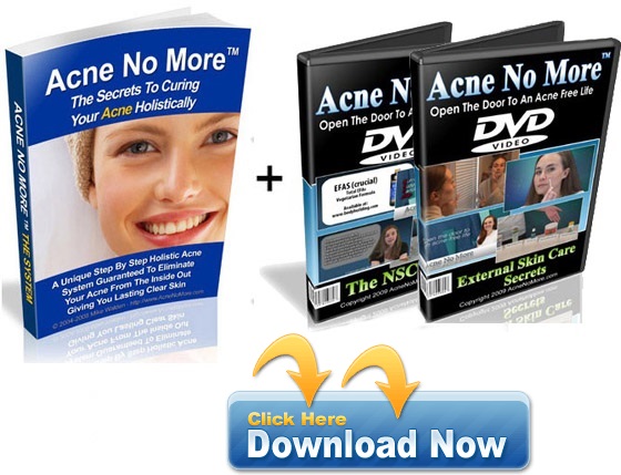 acne no more pdf free download